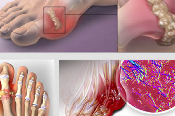 Apa yang Didukung oleh OVISURE GOLD OVISURE GOLD (3)